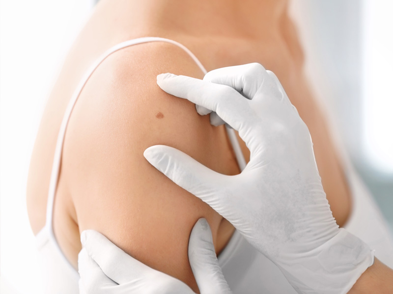 Dr. med. Heike Geiger - Fachärztin für Dermatologie Venerologie, Allergologie und Phlebologie